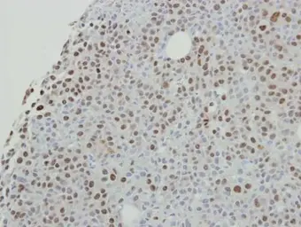 Anti-SAFB2 antibody [N2C1], Internal used in IHC (Paraffin sections) (IHC-P). GTX115272