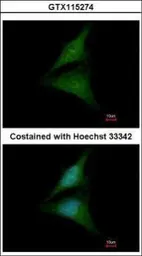 Anti-Importin 13 antibody [N1N2], N-term used in Immunocytochemistry/ Immunofluorescence (ICC/IF). GTX115274