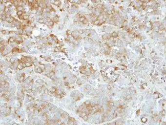 Anti-Importin 13 antibody [N1N2], N-term used in IHC (Paraffin sections) (IHC-P). GTX115274