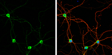 Anti-Pumilio 1 antibody [C2C3], C-term used in Immunocytochemistry/ Immunofluorescence (ICC/IF). GTX115280