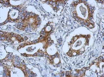 Anti-Strumpellin antibody [C2C3], C-term used in IHC (Paraffin sections) (IHC-P). GTX115311