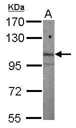 Anti-ARNT2 antibody [N2C1], Internal used in Western Blot (WB). GTX115314