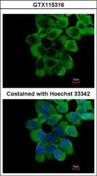 Anti-RNF10 antibody used in Immunocytochemistry/ Immunofluorescence (ICC/IF). GTX115316