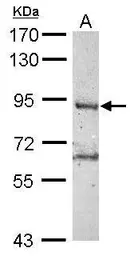 Anti-RNF10 antibody used in Western Blot (WB). GTX115316
