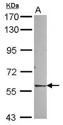 Anti-NR1D2 antibody [N3C2], Internal used in Western Blot (WB). GTX115322
