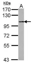 Anti-PPP4R1 antibody [N1N3] used in Western Blot (WB). GTX115325