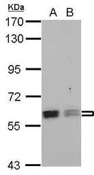 Anti-ROD1 antibody [C1C3] used in Western Blot (WB). GTX115327