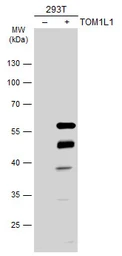 Anti-TOM1L1 antibody used in Western Blot (WB). GTX115334