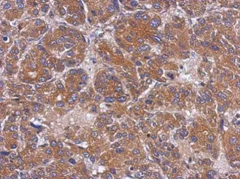 Anti-TOM1L1 antibody used in IHC (Paraffin sections) (IHC-P). GTX115334