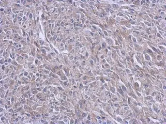 Anti-FARSB antibody used in IHC (Paraffin sections) (IHC-P). GTX115336