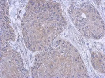 Anti-FARSB antibody used in IHC (Paraffin sections) (IHC-P). GTX115336