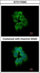 Anti-p41-ARCb antibody used in Immunocytochemistry/ Immunofluorescence (ICC/IF). GTX115343