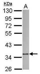 Anti-p41-ARCb antibody [N2C2], Internal used in Western Blot (WB). GTX115344