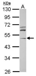 Anti-Arp3 antibody used in Western Blot (WB). GTX115345