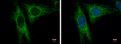 Anti-LRP130 antibody [N2N3] used in Immunocytochemistry/ Immunofluorescence (ICC/IF). GTX115351