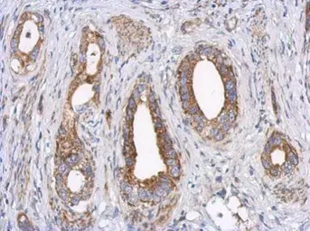 Anti-LRP130 antibody [N2N3] used in IHC (Paraffin sections) (IHC-P). GTX115351