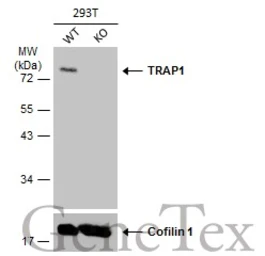 Anti-TRAP1 antibody [N1N3] used in Western Blot (WB). GTX115352