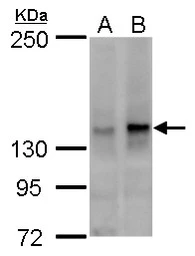 Anti-SFRS14 antibody used in Western Blot (WB). GTX115357