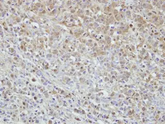 Anti-MPHOSPH6 antibody [N1C3] used in IHC (Paraffin sections) (IHC-P). GTX115368
