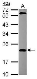Anti-MPHOSPH6 antibody [N1C3] used in Western Blot (WB). GTX115368