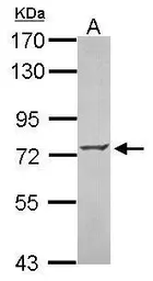 Anti-ZNF443 antibody [N1N2], N-term used in Western Blot (WB). GTX115372