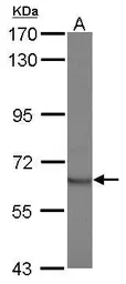Anti-STAM2 antibody [N1N3] used in Western Blot (WB). GTX115382
