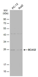 Anti-BCAS2 antibody used in Western Blot (WB). GTX115390