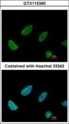 Anti-BCAS2 antibody used in Immunocytochemistry/ Immunofluorescence (ICC/IF). GTX115390