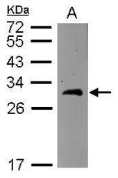 Anti-BCAS2 antibody used in Western Blot (WB). GTX115390