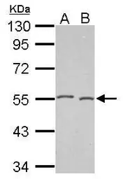 Anti-DNAJA2 antibody [N1C2] used in Western Blot (WB). GTX115393