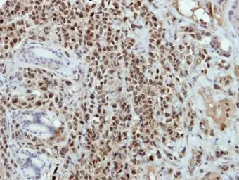Anti-BRAF35 antibody [N2C3] used in IHC (Paraffin sections) (IHC-P). GTX115399