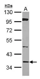 Anti-BRAF35 antibody [N2C3] used in Western Blot (WB). GTX115399