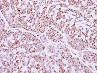 Anti-IRF9 antibody used in IHC (Paraffin sections) (IHC-P). GTX115401