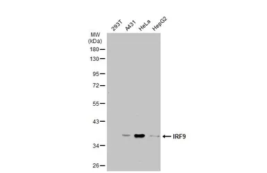 Anti-IRF9 antibody used in Western Blot (WB). GTX115401