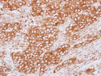Anti-beta Tubulin 2C antibody [N2C2], Internal used in IHC (Paraffin sections) (IHC-P). GTX115403