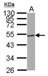 Anti-beta Tubulin 2C antibody [N2C2], Internal used in Western Blot (WB). GTX115403