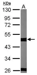 Anti-beta Tubulin 2C antibody [C1C3] used in Western Blot (WB). GTX115404