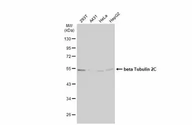 Anti-beta Tubulin 2C antibody [C1C3] used in Western Blot (WB). GTX115404