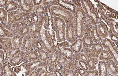 Anti-beta Tubulin 2C antibody [C1C3] used in IHC (Paraffin sections) (IHC-P). GTX115404