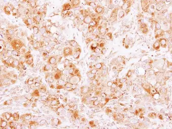 Anti-Coronin 2B antibody [N1C1] used in IHC (Paraffin sections) (IHC-P). GTX115405