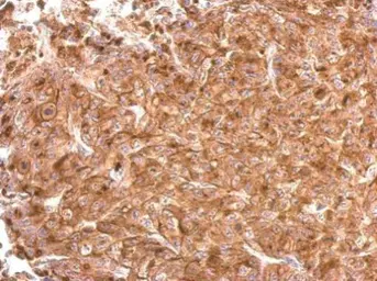 Anti-IFITM3 antibody used in IHC (Paraffin sections) (IHC-P). GTX115407