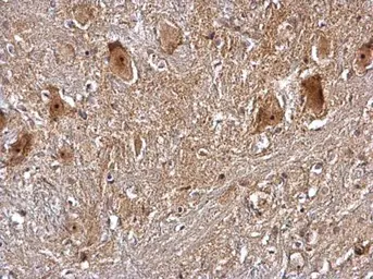 Anti-PRMT5 antibody [N3C3] used in IHC (Paraffin sections) (IHC-P). GTX115409