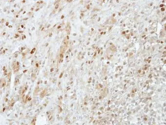 Anti-PRMT5 antibody [N3C3] used in IHC (Paraffin sections) (IHC-P). GTX115409