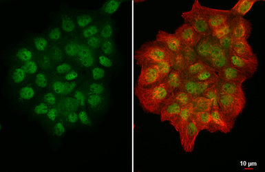 Anti-PRMT5 antibody [N3C3] used in Immunocytochemistry/ Immunofluorescence (ICC/IF). GTX115409