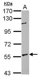 Anti-BAIAP2 antibody used in Western Blot (WB). GTX115421