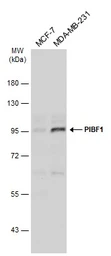Anti-PIBF1 antibody used in Western Blot (WB). GTX115423