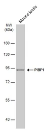 Anti-PIBF1 antibody used in Western Blot (WB). GTX115423