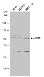 Anti-PIBF1 antibody used in Western Blot (WB). GTX115423