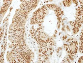 Anti-ANP32B antibody used in IHC (Paraffin sections) (IHC-P). GTX115437