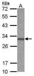Anti-ANP32B antibody used in Western Blot (WB). GTX115437